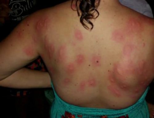 Control del mosquit tigre i la mosca negra